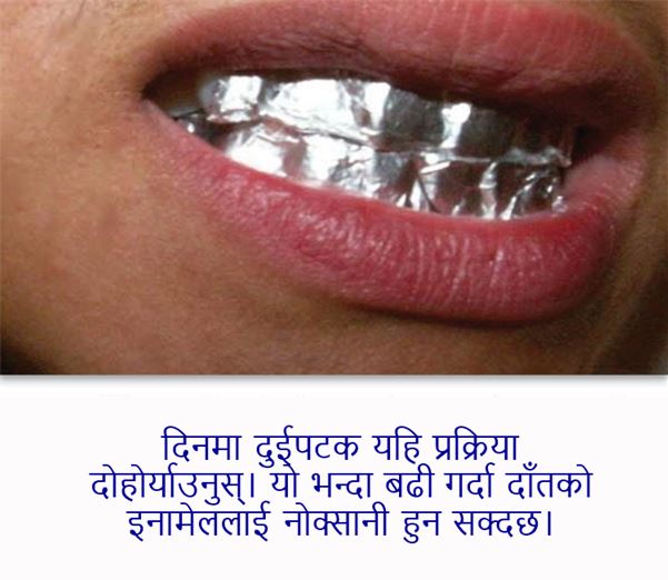 almunium-foil-in-teeth-22017311