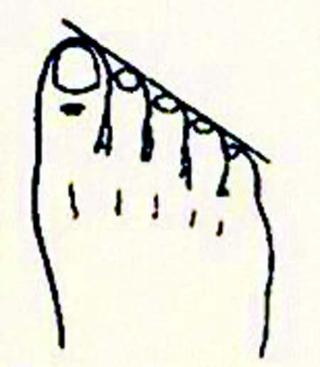 foot shape
