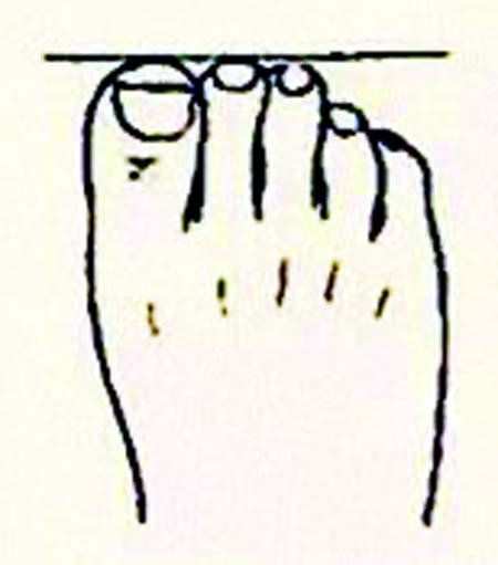 foot shape