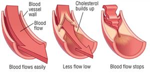 cholesterol and blood flow