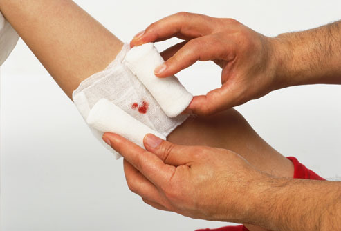 Introducing a new bandage that sucks bacteria out of a wound