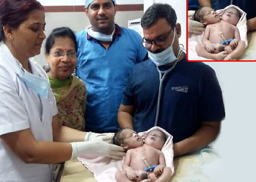 एक महिलाले जन्माइन् अनौठो शिशु, डाक्टर भन्छन्: विश्वमै दुर्लभ